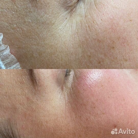 Услуги косметолога