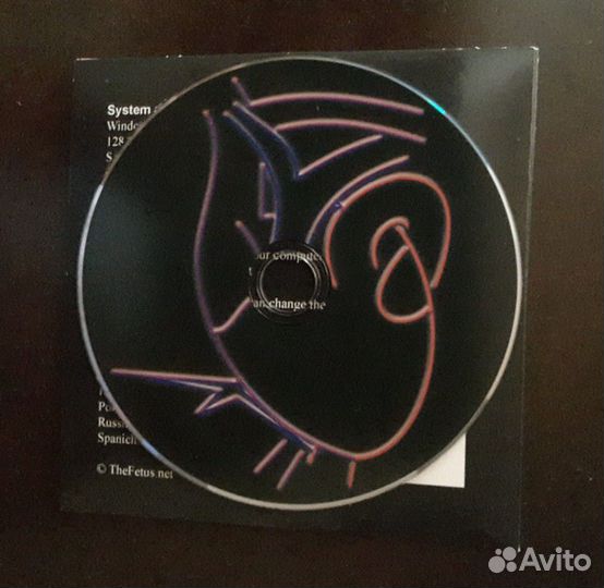 Уз-диагностика аномалий сердца плода. CD