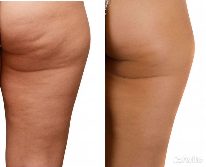 Массаж в Кемерово, все виды