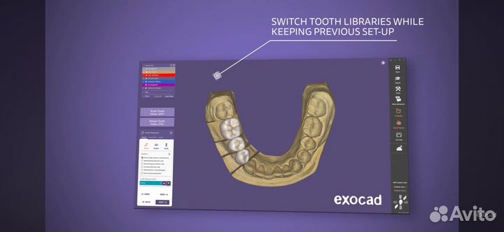 Exocad 3.2 Elefsina 2024 все модули + обучение