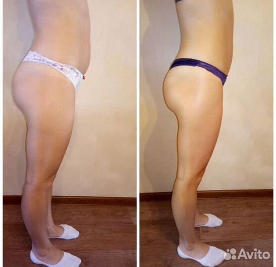 Массаж антицеллюлитный,мадейратерапия,классический