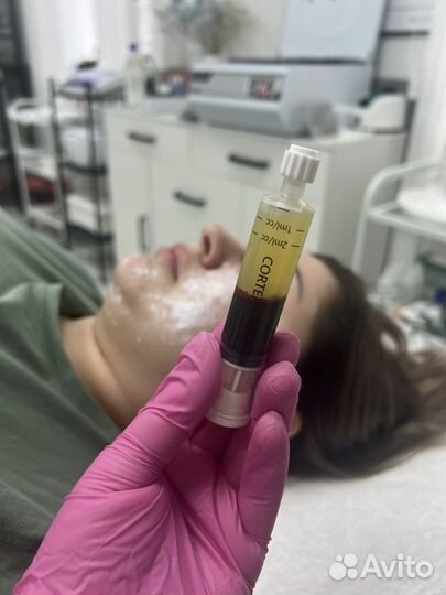 PRP терапия. Плазмолифтинг