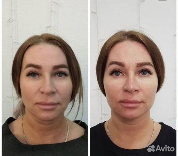 Массаж лица