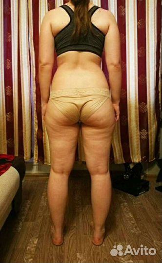 Массаж антицеллюлитный выезд на дом