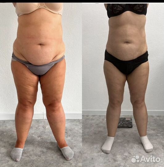 Массаж/ коррекция фигуры/снижение веса/LPG