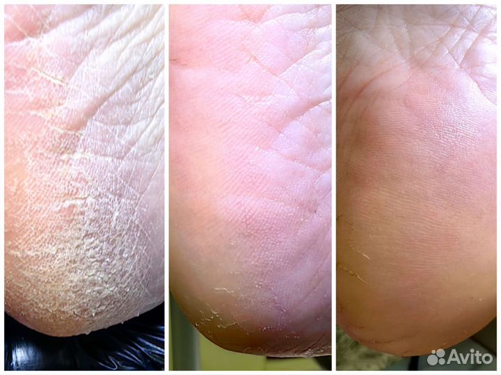 Модель маникюр/педикюр подология