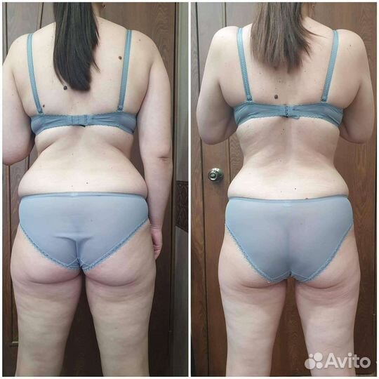 Коррекция фигуры/ скульптурный массаж