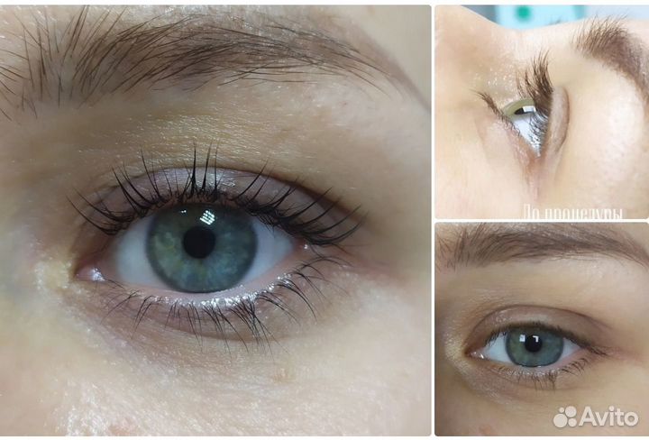 Подологический педикюр