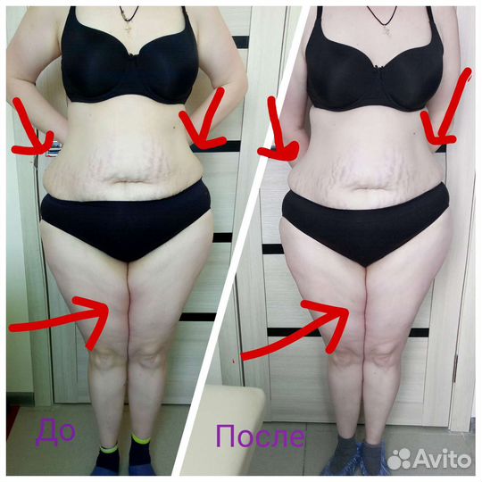 Аппаратный массаж