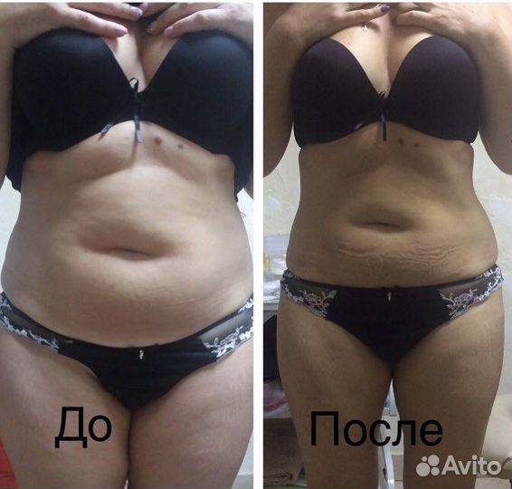 Массаж лица, антицеллюлитный, классический, лимфо