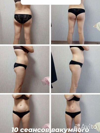 Вакуумный массаж