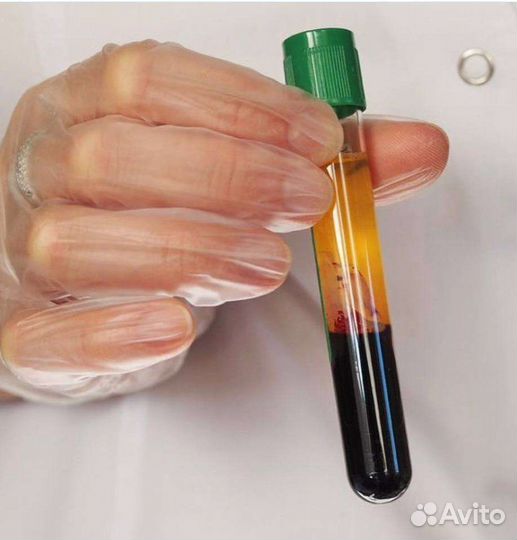 Плазмолифтинг