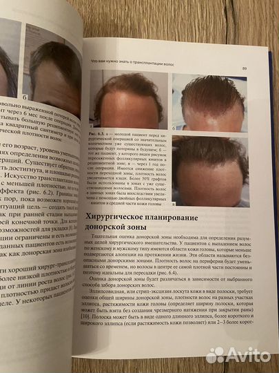 Лечение волос и кожи головы. руководство