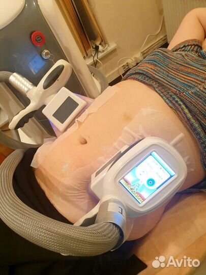 Криолиполиз,антицеллюлитный массаж