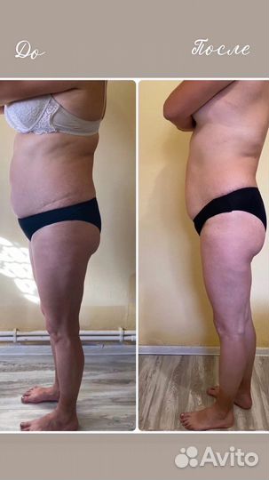 Массажист lpg