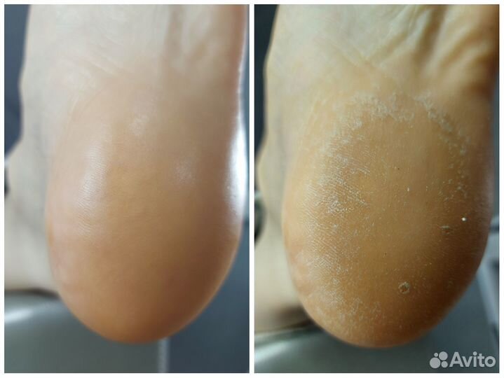 Педикюр(Smart)