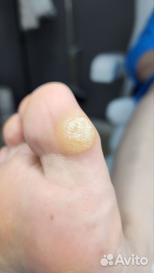 Услуги подолога