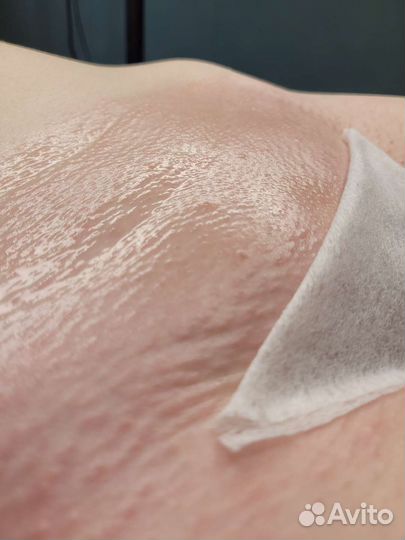 Шугаринг: бёдра