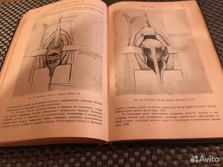 Техника Гинекологических операций Левит 1938