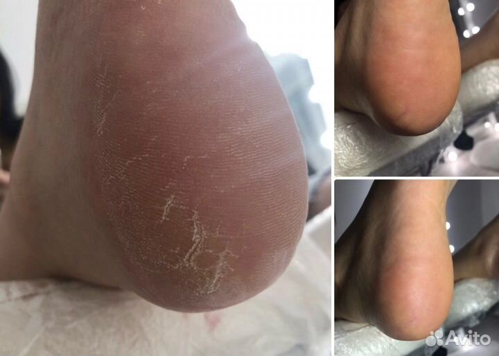 Маникюр, педикюр Южный город 1