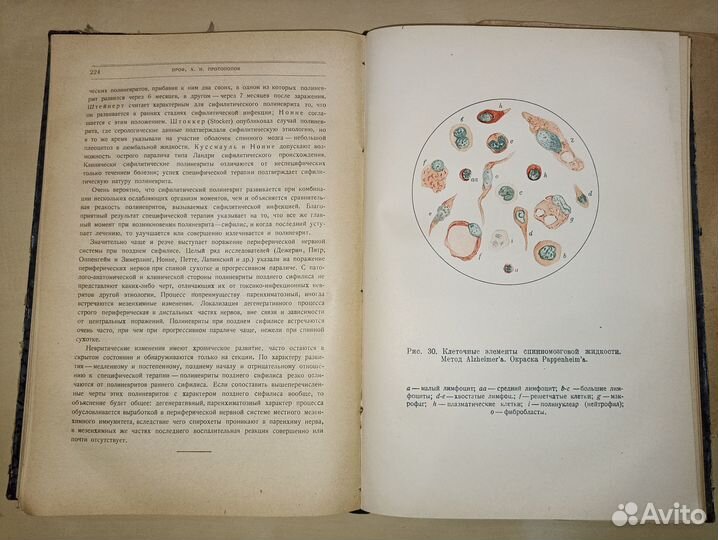 Сифилис нервной системы. Абрикосов. 1927