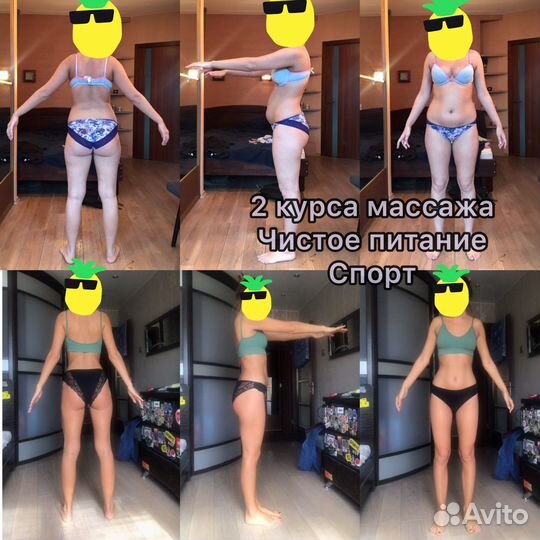 Антицеллюлитный массаж