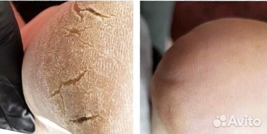 Smart педикюр ламинирование ресниц. звоните