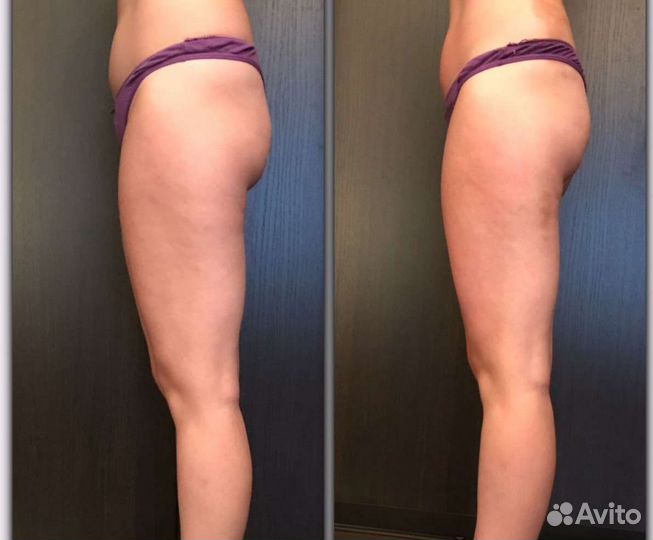 Массаж для мужчин и женщин