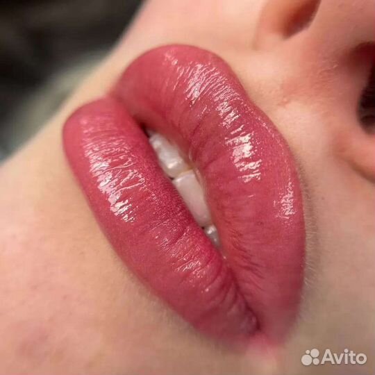 Увеличение губ