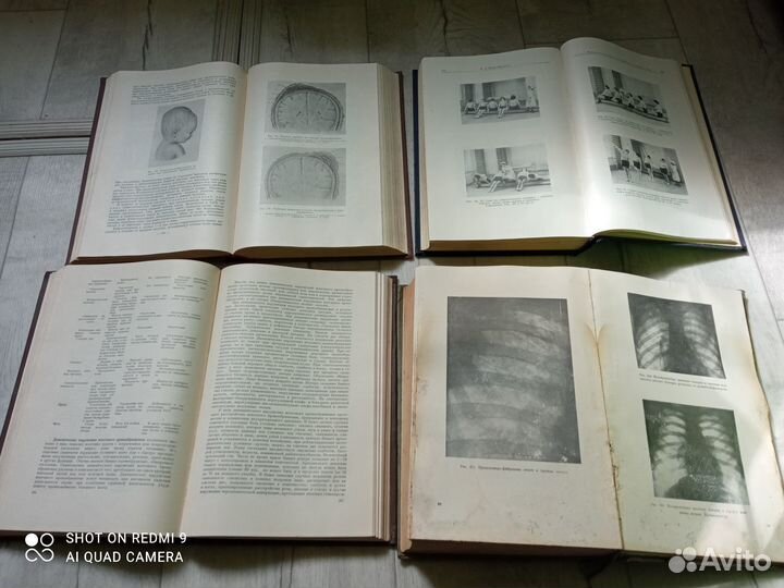 Книги по медицине.50-60г 90х