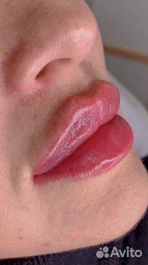 Тренер косметолог обучение модели