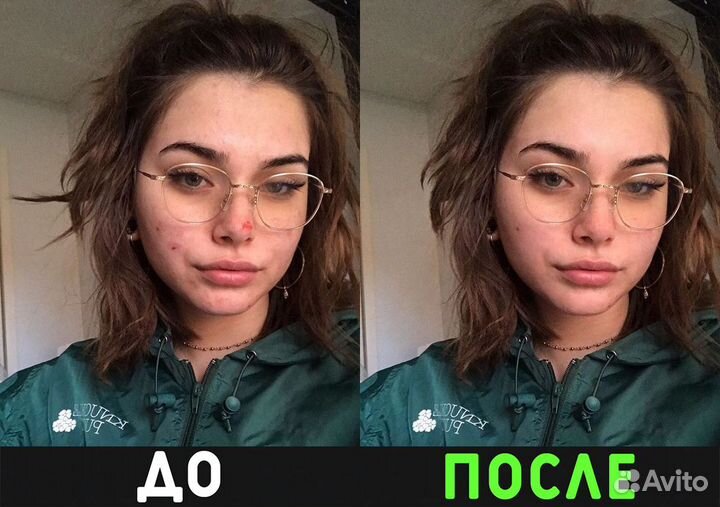 Обработка фотографий / Фотошоп / Ретушь фотографий