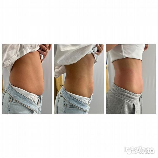 Коррекция фигуры/антицеллюлитная программа