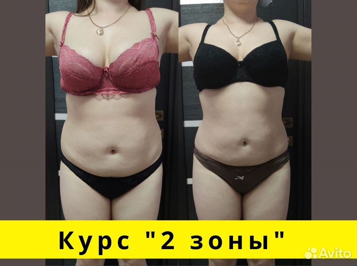 Массаж для коррекции фигуры/Тейпирование