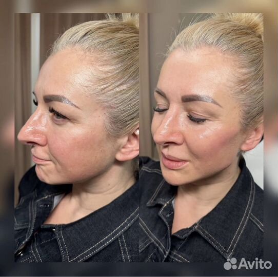 Full face, косметолог обучение, увеличение губ