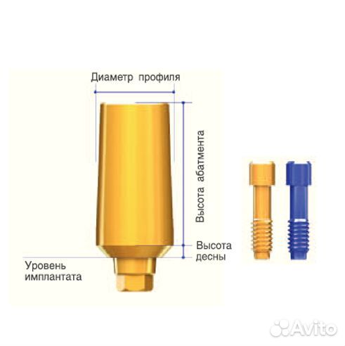 Абатмент AnyRidge Extra EZ Post 6.5 десна 1.0 мм
