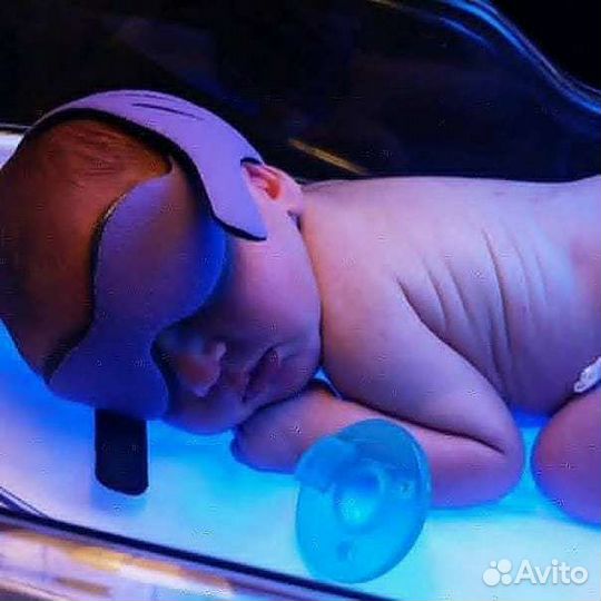 Лампа от желтушки Аренда