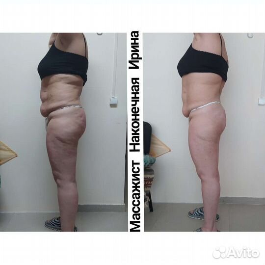 Массаж лечебный/Коррекция фигуры