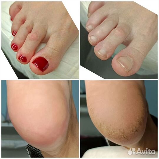 Подолог Педикюр мужской и женский