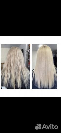 Нанопластика floractive, ботокс, биксипластия