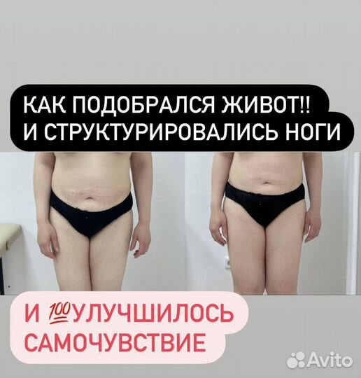 Массаж