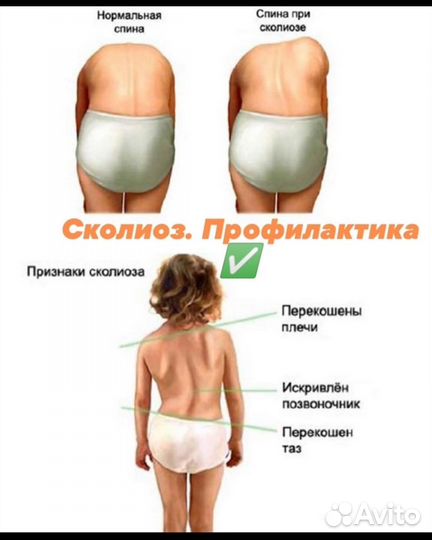 Детский массаж