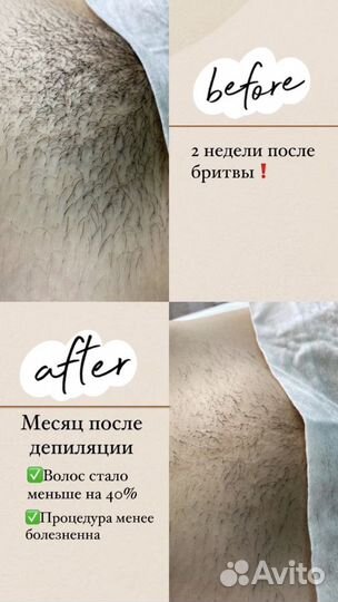 Шугаринг/Скинс/Воск/Депиляция/Ленина