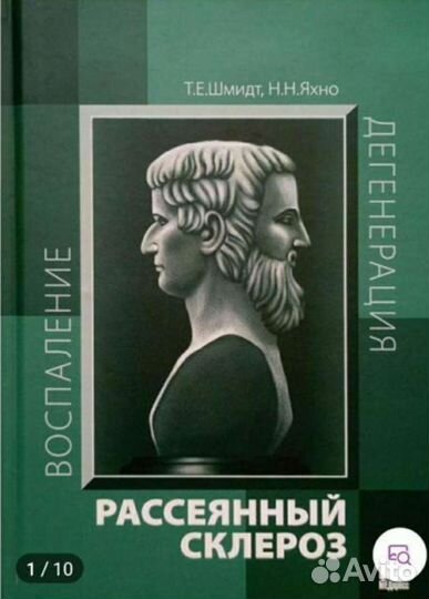 Рассеянный склероз новая
