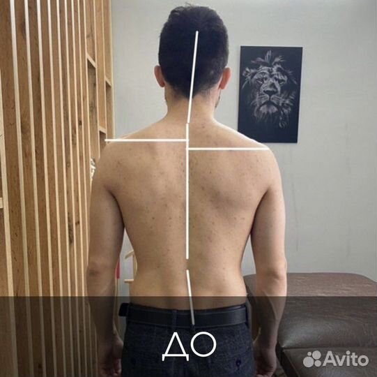 Мануальный терапевт