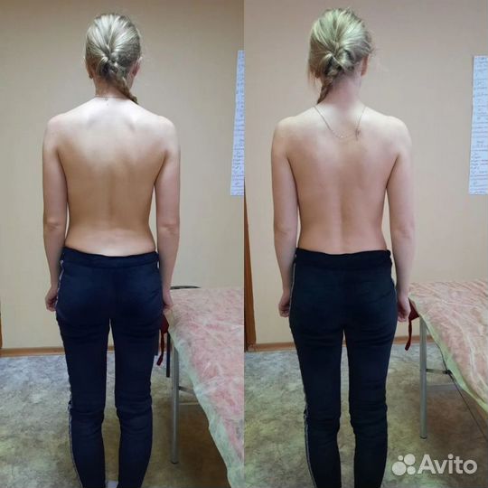 Восстановление/Остеопат/Коррекция