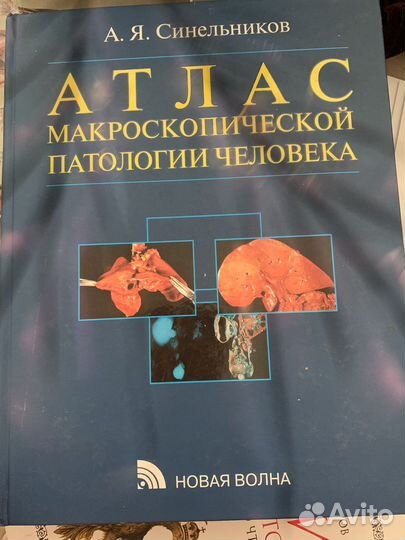 Атлас микроскопической патологии человека