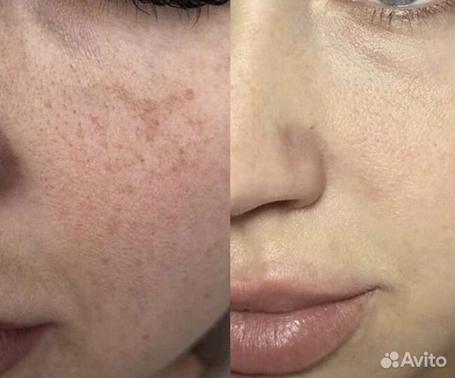 Bb glow тональный крем на год