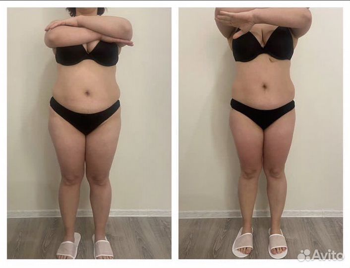 Массаж коррекция фигуры