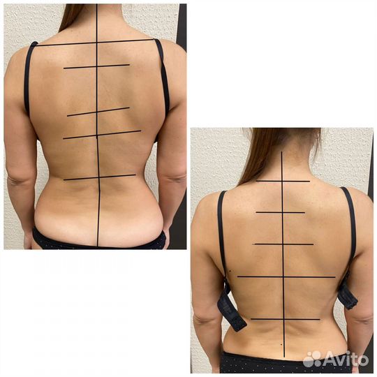 Костоправ мануальщик